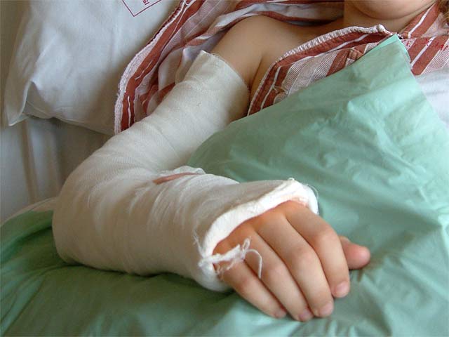 könyökízületi törések tünetei és kezelése 1 lábujjkezelés metatarsofalangealis artrosis